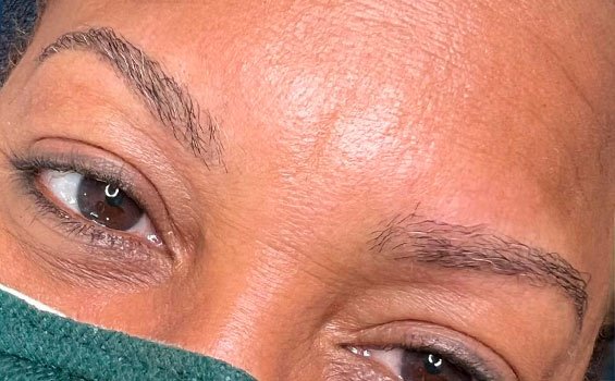 eyebrows-before eyebrows-before